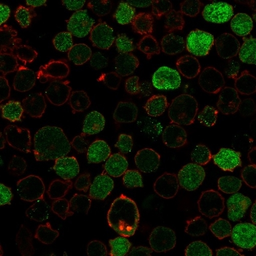 Anti-BCL10 antibody [BL10/2988R] used in Immunocytochemistry/ Immunofluorescence (ICC/IF). GTX02597
