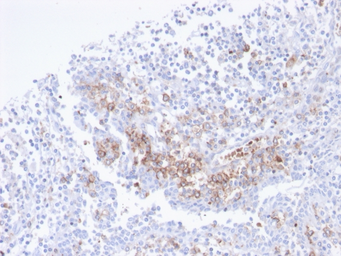 Anti-CD38 antibody [CD38/4247R] used in IHC (Paraffin sections) (IHC-P). GTX02603