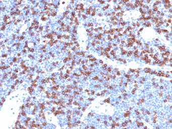 Anti-CD8 alpha antibody [CD8/4391R] used in Protein Array (Protein Array). GTX02616