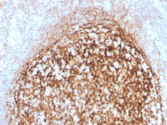 Anti-CD35 antibody [CR1/4382R] used in IHC (Paraffin sections) (IHC-P). GTX02623