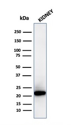Anti-Ferritin Light Chain antibody [FTL/3872R] used in Western Blot (WB). GTX02642