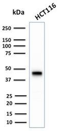 Anti-Cytokeratin 18 antibody [KRT18/2808R] used in Western Blot (WB). GTX02657