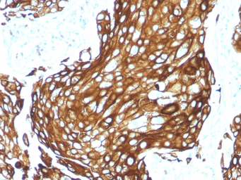 Anti-Keratin 77 antibody [KRTL/1577R] used in IHC (Paraffin sections) (IHC-P). GTX02667