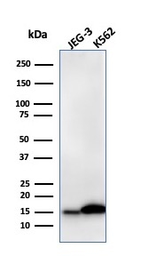 Anti-Galectin 1 antibody [GAL1/2499R] used in Western Blot (WB). GTX02670