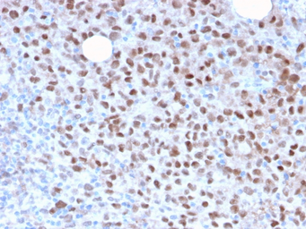 Anti-MITF antibody [MITF/2987R] used in IHC (Paraffin sections) (IHC-P). GTX02674