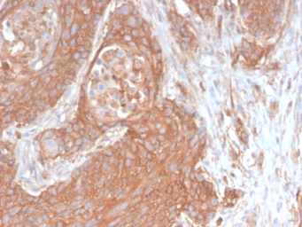 Anti-SPTBN2 antibody [SPTBN2/2894R] used in IHC (Paraffin sections) (IHC-P). GTX02716