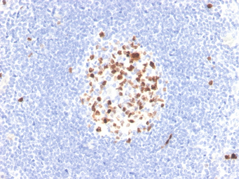 Anti-Topoisomerase II alpha antibody [TOP2A/4397R] used in IHC (Paraffin sections) (IHC-P). GTX02727