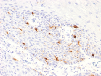 Anti-TRP1 antibody [TYRP1/2340R] used in IHC (Paraffin sections) (IHC-P). GTX02736
