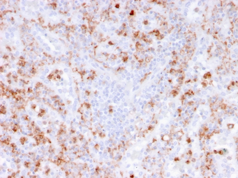 Anti-S100A8 + S100A9 antibody [rMAC3781] used in IHC (Paraffin sections) (IHC-P). GTX02752