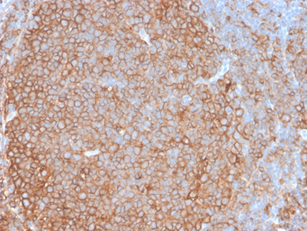 Anti-MHC Class II antibody [HLA-Pan/2967R] used in IHC (Paraffin sections) (IHC-P). GTX02758