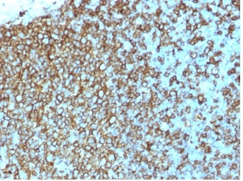 Anti-MHC Class II antibody [rHLA-Pan/3475] used in IHC (Paraffin sections) (IHC-P). GTX02759