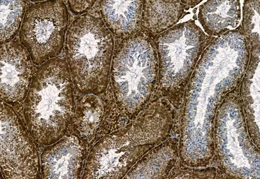 Anti-NAK / TBK1 (phospho Ser172) antibody used in IHC (Paraffin sections) (IHC-P). GTX02815