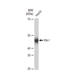 Anti-PAI-1 antibody [GT1223] used in Western Blot (WB). GTX02817