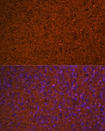 Anti-Hemoglobin alpha antibody [GT1234] used in IHC (Paraffin sections) (IHC-P). GTX02831