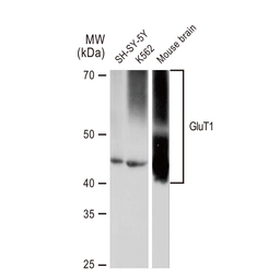 Anti-GluT1 antibody [GT1235] used in Western Blot (WB). GTX02832