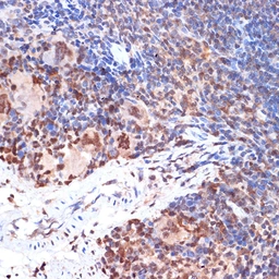 Anti-5-Lipoxygenase antibody [GT1241] used in IHC (Paraffin sections) (IHC-P). GTX02838