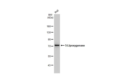 Anti-5-Lipoxygenase antibody [GT1241] used in Western Blot (WB). GTX02838