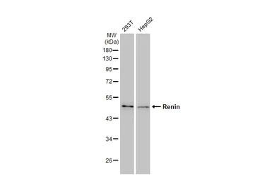 Anti-Renin antibody [GT1245] used in Western Blot (WB). GTX02842