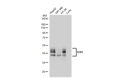 Anti-TFPI antibody [GT1246] used in Western Blot (WB). GTX02843