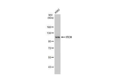 Anti-ITCH antibody [GT1248] used in Western Blot (WB). GTX02845