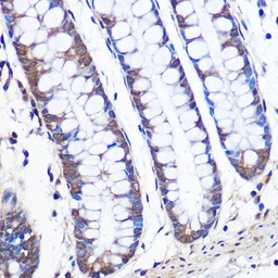 Anti-ERK5 antibody [GT1258] used in IHC (Paraffin sections) (IHC-P). GTX02855