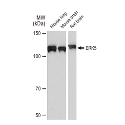 Anti-ERK5 antibody [GT1258] used in Western Blot (WB). GTX02855