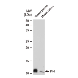 Anti-PF4 antibody [GT1260] used in Western Blot (WB). GTX02857