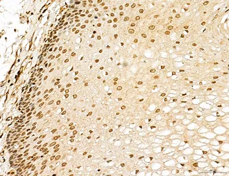 Anti-LASS2 antibody used in IHC (Paraffin sections) (IHC-P). GTX02887