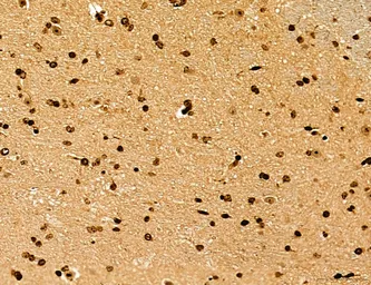 Anti-LASS2 antibody used in IHC (Paraffin sections) (IHC-P). GTX02887