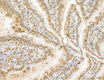 Anti-LASS2 antibody used in IHC (Paraffin sections) (IHC-P). GTX02887