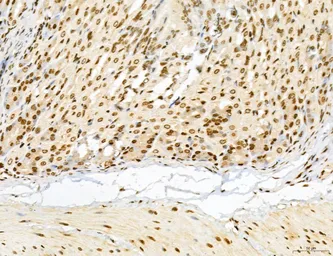 Anti-LASS2 antibody used in IHC (Paraffin sections) (IHC-P). GTX02887