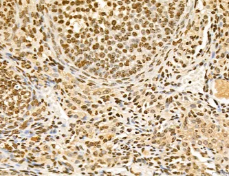 Anti-LASS2 antibody used in IHC (Paraffin sections) (IHC-P). GTX02887