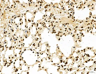 Anti-LASS2 antibody used in IHC (Paraffin sections) (IHC-P). GTX02887