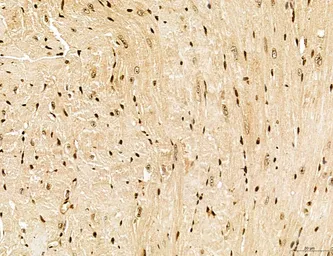 Anti-LASS2 antibody used in IHC (Paraffin sections) (IHC-P). GTX02887