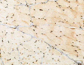 Anti-LASS2 antibody used in IHC (Paraffin sections) (IHC-P). GTX02887