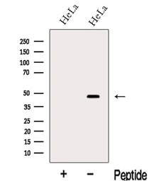 Anti-LASS2 antibody used in Western Blot (WB). GTX02887
