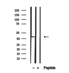 Anti-ASBT antibody used in Western Blot (WB). GTX03115