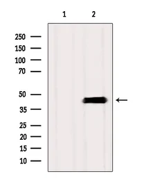 Anti-ASBT antibody used in Western Blot (WB). GTX03115