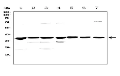 Anti-uPAR antibody used in Western Blot (WB). GTX03117
