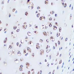 Anti-Aggrecan antibody [GT1267] used in IHC (Paraffin sections) (IHC-P). GTX03179