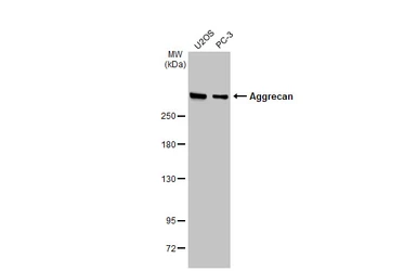 Anti-Aggrecan antibody [GT1267] used in Western Blot (WB). GTX03179