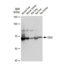 Anti-CES1 antibody [GT1271] used in Western Blot (WB). GTX03183