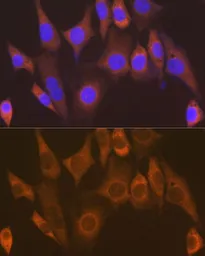 Anti-EEF1G antibody [GT1278] used in Immunocytochemistry/ Immunofluorescence (ICC/IF). GTX03190