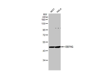 Anti-EEF1G antibody [GT1278] used in Western Blot (WB). GTX03190