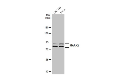 Anti-MARK2 antibody [GT1279] used in Western Blot (WB). GTX03191