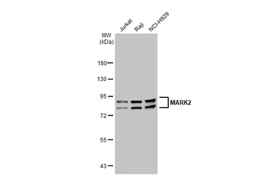 Anti-MARK2 antibody [GT1279] used in Western Blot (WB). GTX03191