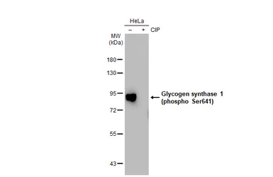 Anti-Glycogen synthase 1 (phospho Ser641) antibody [GT1284] used in Western Blot (WB). GTX03196