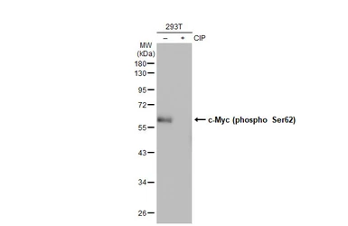 Anti-c-Myc (phospho Ser62) antibody [GT1295] used in Western Blot (WB). GTX03207