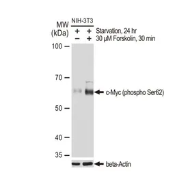 Anti-c-Myc (phospho Ser62) antibody [GT1295] used in Western Blot (WB). GTX03207
