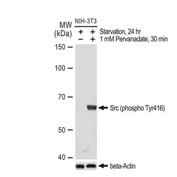 Anti-Src (phospho Tyr416) antibody [GT1314] used in Western Blot (WB). GTX03226